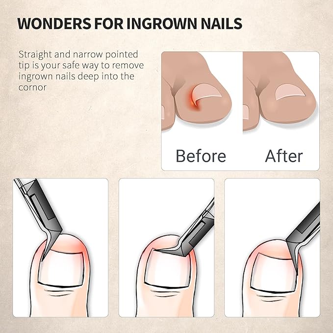 FERYES Toenail Clipper Straight Blade for Ingrown and Thick Nails - Stainless Steel and Sharp Pointed Tip Ingrown Nail Clipper – Wide Jaw Toe Nail Cutter Podiatry Tool Dark Gray
