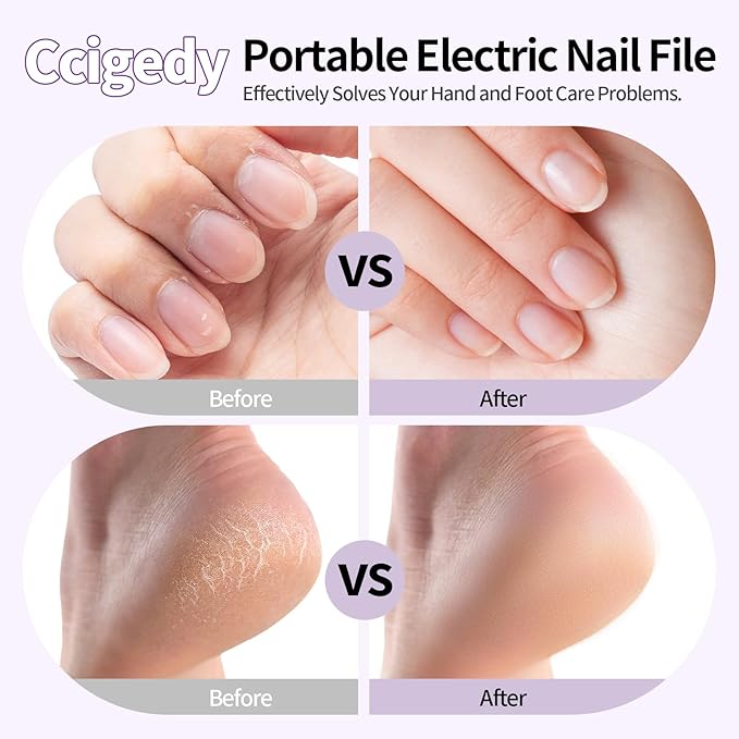 Professional Manicure Pedicure Kit, Cordless Electric Nail File with LCD & Lamp, Rechargeable Toenail Grinder for Thick Toenails, Portable Nail Dremel Tools for Women & Men Baby Pets