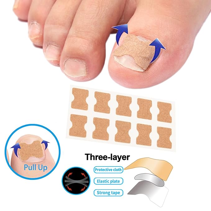 Professional Ingrown Toenail Correction Kit - Stainless Steel Ingrown Toenail Clippers, Correction Patches, Lifter & Tools for Ingrown Toenail Treatment, Home Pedicure Solution