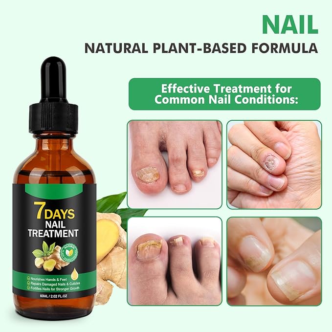 Ginger Nail Growth Serum,Ginger Cuticle Care Oil for Strengthen & Promote Nails Growth, Natural Plant Formula