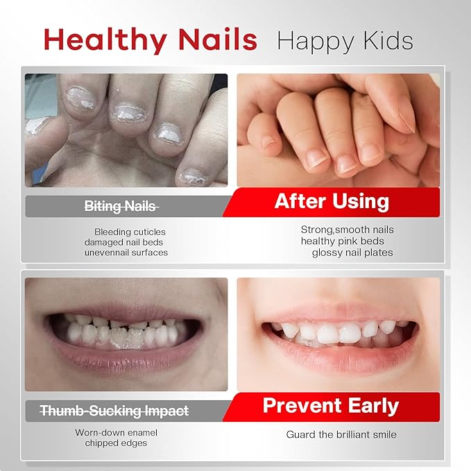 Nail Biting Prevention For Kids: 12ml Extra Strong Nail Biting Treatment Anti Toddler Thumb Sucking Deterrent Stopper Nail Repair for Damaged Nails 48H Long Lasting Matte Odorless Onychophagy Relief
