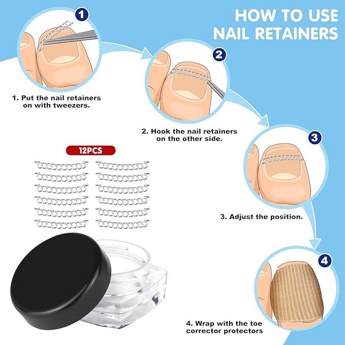 Ingrown Toenail Removal Kit, Professional Ingrown Toenail Treatment Includes Ingrown Toenail Corrector, Tweezer, 50pcs Corrector Patches, 12 Toenail Braces, 10 Ingrown Toenail Corrector Strips