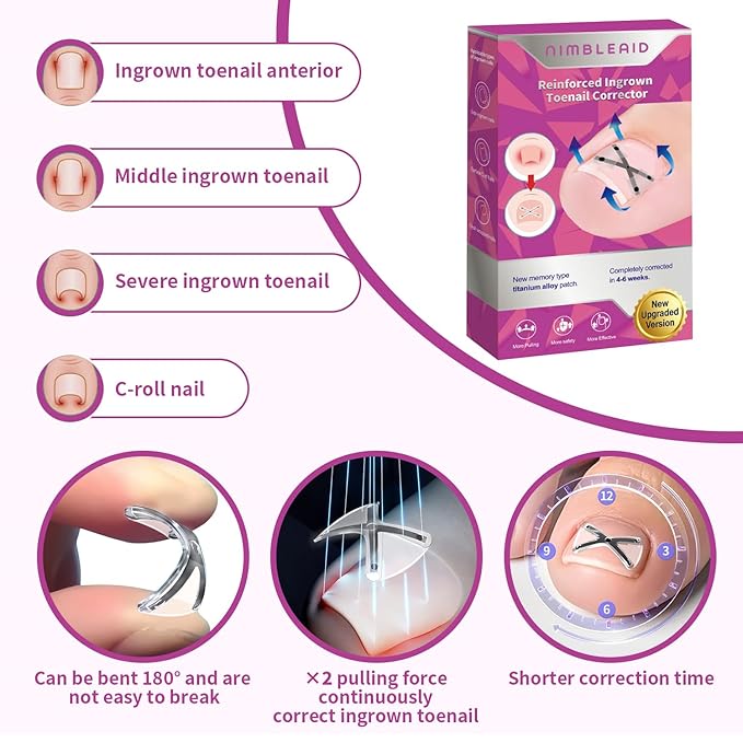 10 Patchs X-Shaped Upgrade Titanium Alloy Ingrown Toenail Corrector,At Home Ingrown Toenail Treatment for Man and Women,Ingrown Toenail Removal Kit,Curved Toenail Straightener (Small Size)