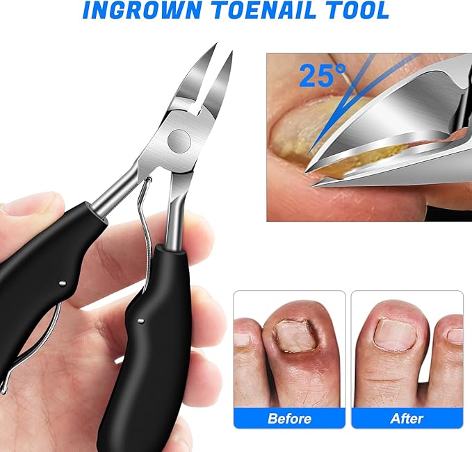 Toenail Clippers for Thick Nails, 6 Pcs Professional Wide Jaw Opening Nail Clipper Set for Seniors, Sharp Stainless Steel Fingernail Cutters with Slanted Edge & Travel Case, Podiatrist Tool Kit
