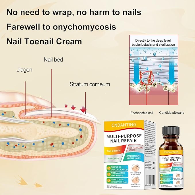 Multi-Purpose Nail Repair with Tolnaftate - Toenail Fungus Treatment Extra Strength Antifungal Solution - Restores Discolored and Damaged Nails - Gentle Formula for Adults & Seniors - 1 fl oz