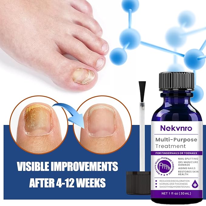 Toenail Fungus Treatment Extra Strength,Nail Fungus Treatment for Toenail,Fungus Nail Treatment Liquid 30ML and Fungal Nail Repair Cream.