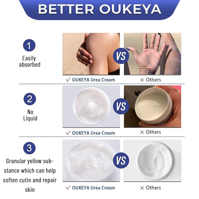 OUKEYA Urea Cream 42% Plus 2% Salicylic Acid – Intensive Foot & Hand Care for Very Dry, Cracked Skin, 5.29 oz (3 Pack)