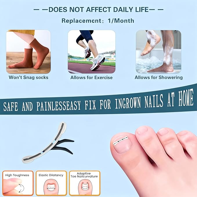 Titanium Alloy Ingrown Toenail Treatment - Professional Home Care for Curved Nails - Waterproof, Nail Tools and Ingrown Toenail Removal Kit,Ingrown Toenail Corrector(0.59/0.67in)