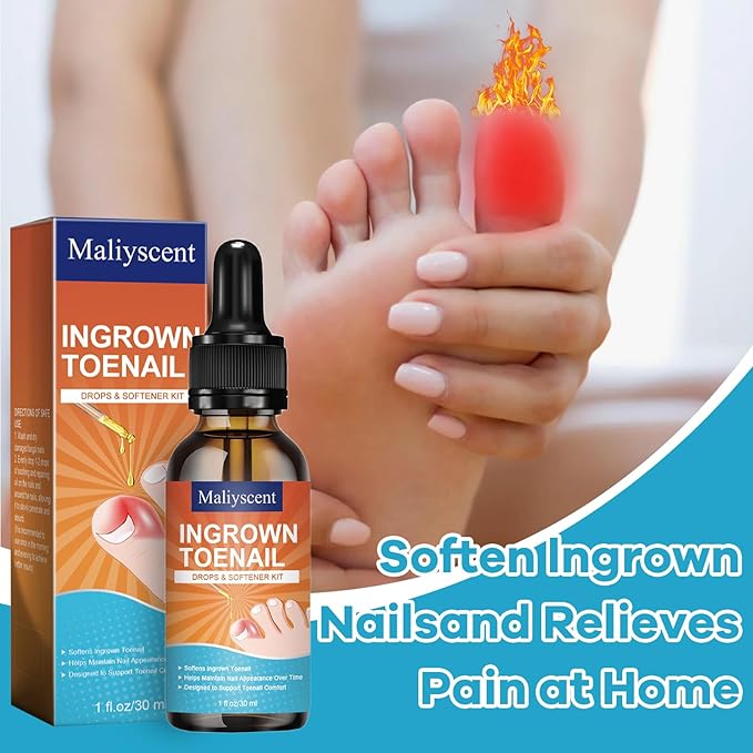 Ingrown Toenail Drop - Ingrown Toenail Pain Reliever and Softener Kit for Men Women Ingrown Toenail Corrector Drops