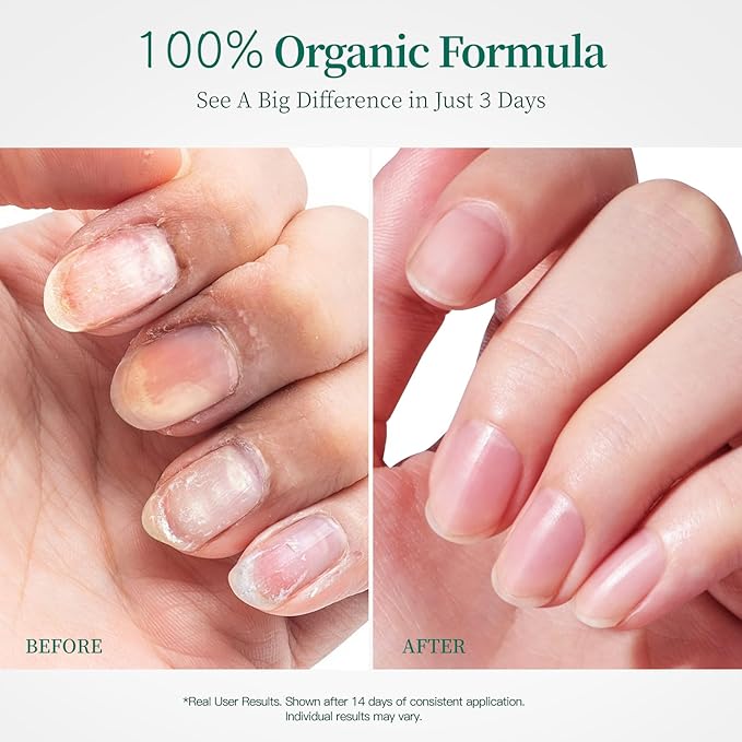 Apuree 100% Bio-Based Cuticle Oil: Nail Strengthener Growth Oil 1oz| Deep Moisture for Extra Dry Cuticles for Brittle Peel Breaking Thin Nails| Black Rose Extract| USDA Verified| Daily Nail Care|Vegan