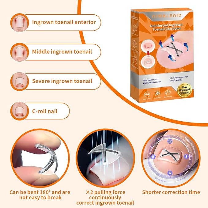 10 Patchs X-Shaped Upgrade Titanium Alloy Ingrown Toenail Corrector,At Home Ingrown Toenail Treatment for Man and Women,Ingrown Toenail Removal Kit,Curved Toenail Corrector (Large Size)