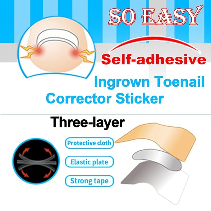 Professional Ingrown Toenail Correction Kit - Stainless Steel Ingrown Toenail Clippers, Correction Patches, Lifter & Tools for Ingrown Toenail Treatment, Home Pedicure Solution