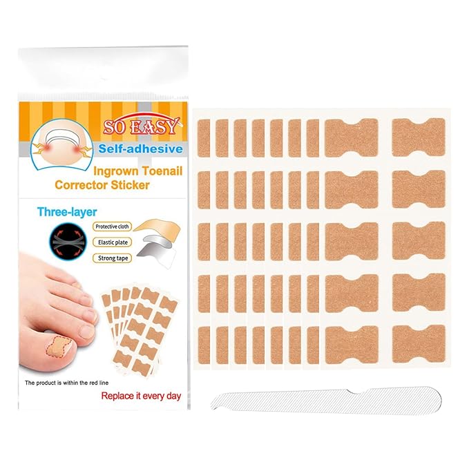 Ingrown Toenail Treatment Strips, 80Pcs Breathable Glue-Free Ingrown Toenail Corrector Patches with File, Professional Non-Slip Toenail Care Tools