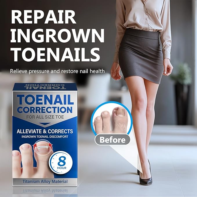 Ingrown Toenail Treatment, Toenail Correction Strips for Curved or Ingrown Nails, Quick Relief, Nail Correction, 5 Different Sizes