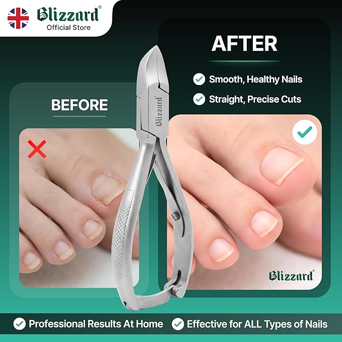Nail Clippers for Men with Thick or Ingrown Toenails – Blizzard Podiatrist Toenail Clipper Set German Forged – 5.5 inch Heavy Duty Nail Cutter – Concave Head Chequered Handles - Hospital Grade