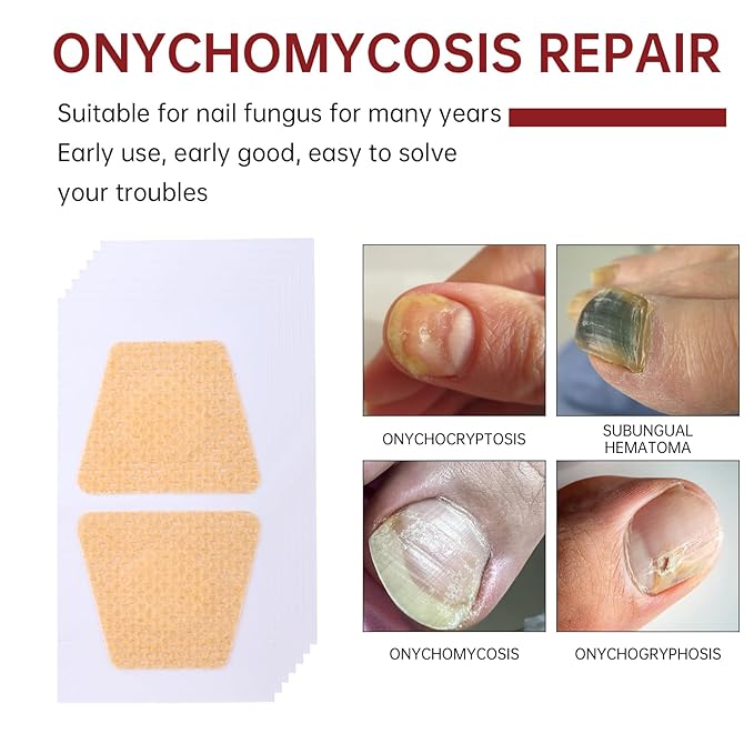 Fungus Nail Treatment Patch, 32 Pcs Foot Fungus Treatment Extra Strength, Nail Fungal Patches for Toenail, Nail Repair for Damaged Nails and Appearance of Discolored