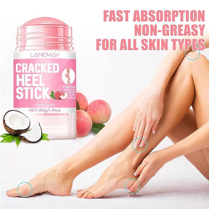 2Pcs Urea Cream 60% for Feet & Dry Cracked Skin, Cracked Heel Repair Stick Maximum Strength Moisturizing Foot & Hand Balm, Repair Creams for Dry Feet, Knee, Elbow and Hand