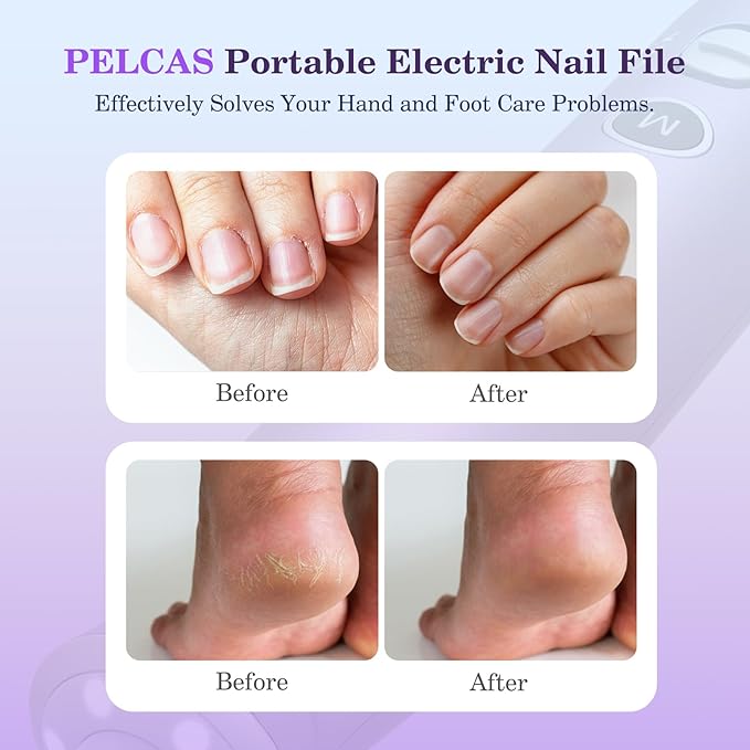 PELCAS Electric Nail Drills, 10 Speeds Cordless Nail File with LED Light, Portable Manicure & Pedicure Kit, Nail Grinder with LCD Screen for Human, Pet, Thick Toenails, Natural & Acrylic Nails Purple