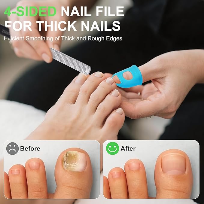 Metal Nail File, Toenail File with Fingertip Protectors and Dual-Ended Toenail Lifter, Double Sided and Files Nails Easily for Seniors, Men & Women Pedicure Tool