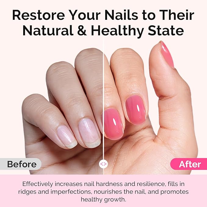 MelodySusie Nail Strengthener and Growth Treatment, 2-in-1 Ridge Filling Base Coat & Glossy Concealer Polish for Damaged Nail Repair and Healthy Shine,Gifts for Women 15ml 0.5 Fl Oz Red