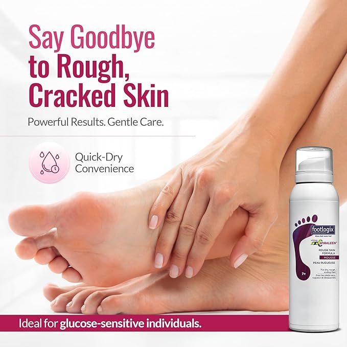 Footlogix Rough Skin Formula with Spiraleen - Mousse for Dry Cracked Heels and Feet, Foot Care for Men and Women, Dry Cracked Feet Treatment, 4.23oz