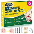 Small Size-Titanium Alloy Ingrown Toenail Treatment & Removal Kit for Quick Relief, Ingrown Toenail Removal Kit， Professional Ingrown Toenail Corrector, Ingrown Toenail Tools for Quick Relief, 10 Pcs