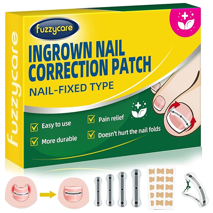 Small Size-Titanium Alloy Ingrown Toenail Treatment & Removal Kit for Quick Relief, Ingrown Toenail Removal Kit， Professional Ingrown Toenail Corrector, Ingrown Toenail Tools for Quick Relief, 10 Pcs