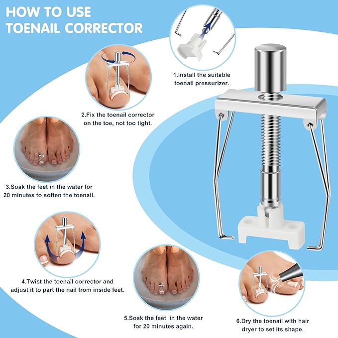 Ingrown Toenail Removal Kit, Professional Ingrown Toenail Treatment Includes Ingrown Toenail Corrector, Tweezer, 50pcs Corrector Patches, 12 Toenail Braces, 10 Ingrown Toenail Corrector Strips