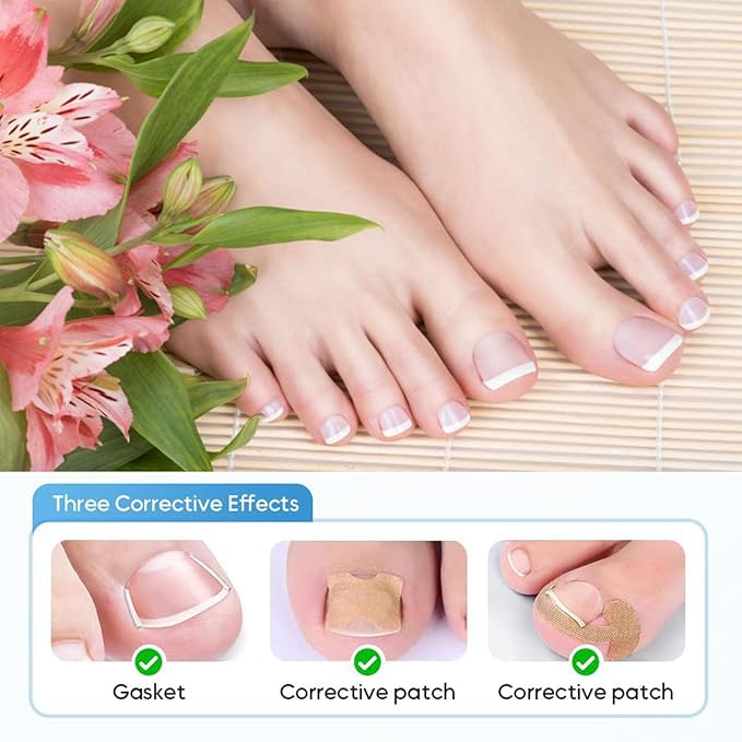 Professional Ingrown Toenail Set with Breathable Ingrown Toenail Strips,Toenail Correction Strips, Curved Toenails Corrector Patch, Painless File and Lifter Pedicure Tools