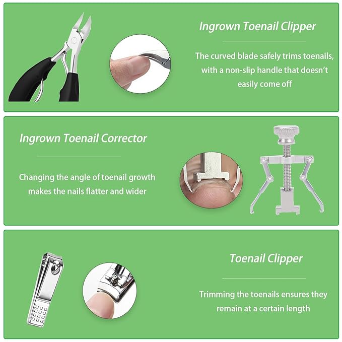 Ingrown Toenail Corrector Set,Professional Foot Care Kit for Treatment & Removal,Includes Ingrown Toenail Corrector,Strips,Tools