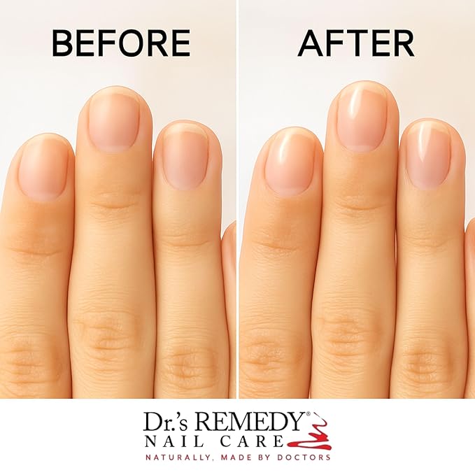 Dr.'s Remedy 4 Pack Nail Polish Treatment Kit, Start To Finish Kit With Total Two-in-One, RADIANT Remover, Therapeutic Cuticle Oil and CLARITY Coral