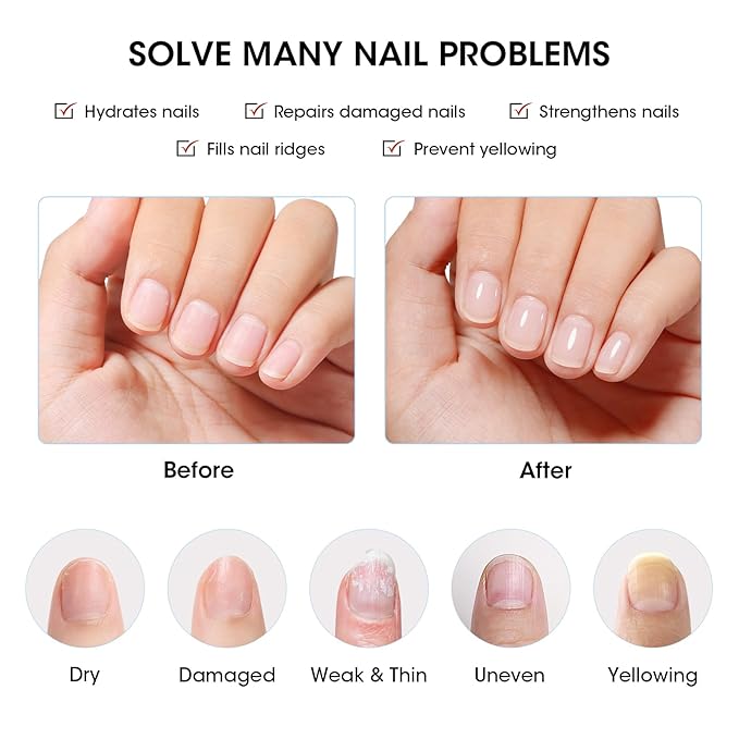 GELLEN Clear Nail Polish Ridge Filling Base Coat, Sheer Milky White Tint Ridge Filler For Nails, Smooth Strengthen Repair Damaged Dry Nails | Shea Butter, Vitamin E, Protein | Toxin HEMA TPO Free