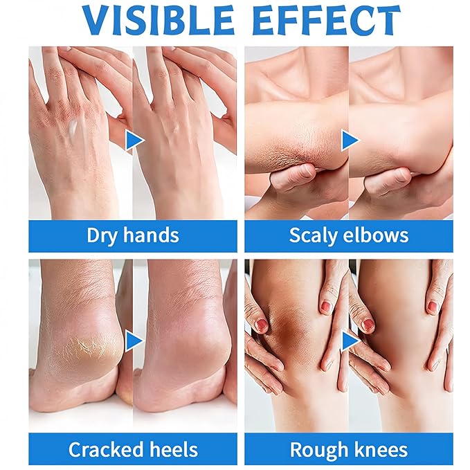 3PCS Foot Balm Stick Set - Manuka Honey Foot Cream, 60% Urea Heel Balm & Peach Scent Cracked Heel Stick - Hydrating Foot Care for Dry Cracked Feet, Heels & Hands, 1.41oz Each