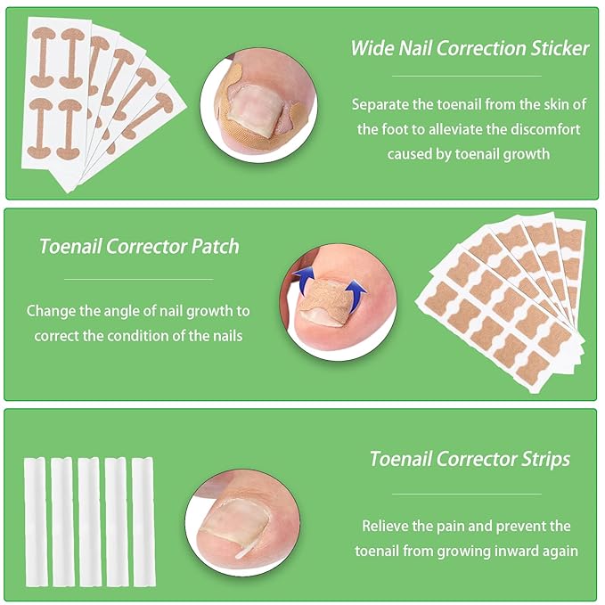 Ingrown Toenail Corrector Set,Professional Foot Care Kit for Treatment & Removal,Includes Ingrown Toenail Corrector,Strips,Tools