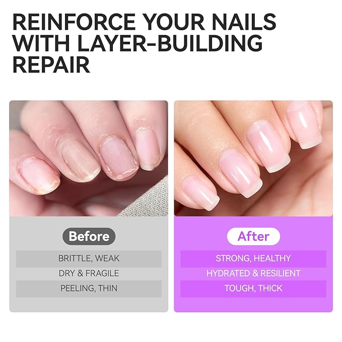 Nail Repair Strengthener for Home Care: Gelike EC 6 in 1 Natural Nail Protein Hardener Extra Strong and Growth - Long Lasting and Fast Dry Polish for Damaged Weak Splitting Break Treatment(Clear 15ml)