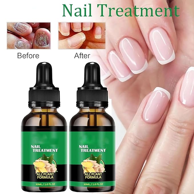 Ginger Nail Growth Strengthener Serum: Ginger-Infused Nail Repair Oil for Care, Natural Nail and Strengthener Solution