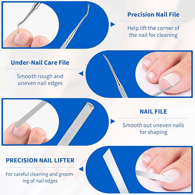 Ingrown Toenail Care Kit with Flexible Strips(134PCS), Professional Toenail Tool Kit Includes Breathable Toenail Bands, Curved Pads, Painless File & Lifter Tools | Home Pedicure Maintenance Set