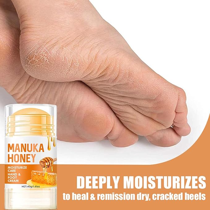 Honey Foot Cream for Extremely Dry, Cracked Skin,Deeply Moisturizing Foot & Hand Balm,Fast-Acting Repair for Rough Heels, Knees, Elbows & Hands for Women & Men - 1.41 oz
