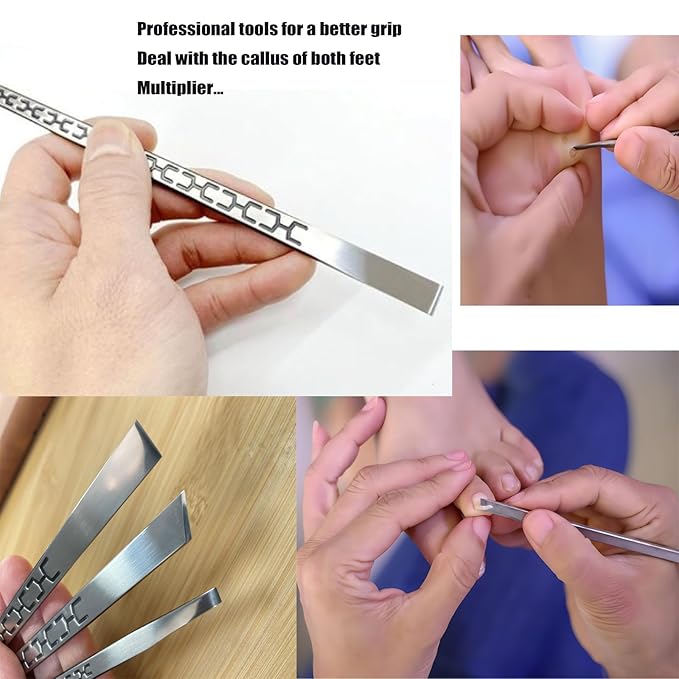 Stainless steel ingrown toenail pedicure knife set,professional foot skin scraper repair sharp blade kit for nail corn callus paronychia treatment. (1)