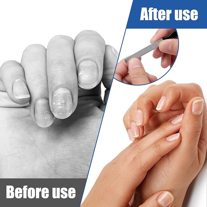 Metal Nail File Men Toe Nail Files for Thick Nails Stainless Steel Long Nails File Toenail Files 4 Sides Heavy Duty for Toenails Fingernail Filing Nail-Care Tool Ideal for Manicure Pedicure Men Women