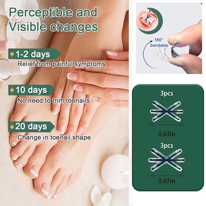 Titanium Alloy Ingrown Toenail Corrector Kit, Toenail Brace Tools for Curved and Ingrown Nails, Self-Adhesive Nail Correction Strips, 2 Sizes (0.63 & 0.67 in)