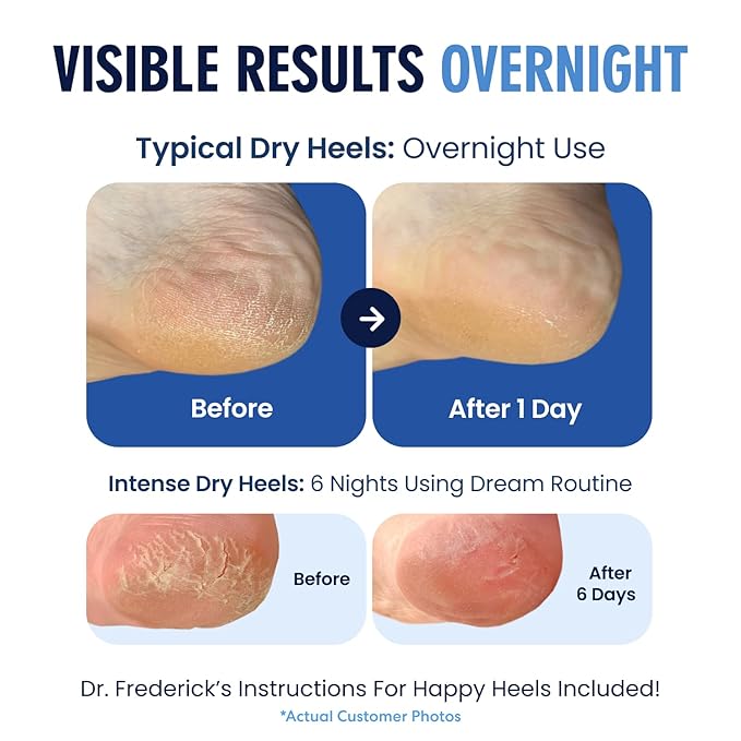 Dr. Frederick's Original Moisturizing Heel Socks for Dry Cracked Heels Treatment - Infused with Olive Oil, Jojoba Oil and Vitamin E - 2 Pairs - Valentines Day Gifts for Her & Him - Blue Jojoba