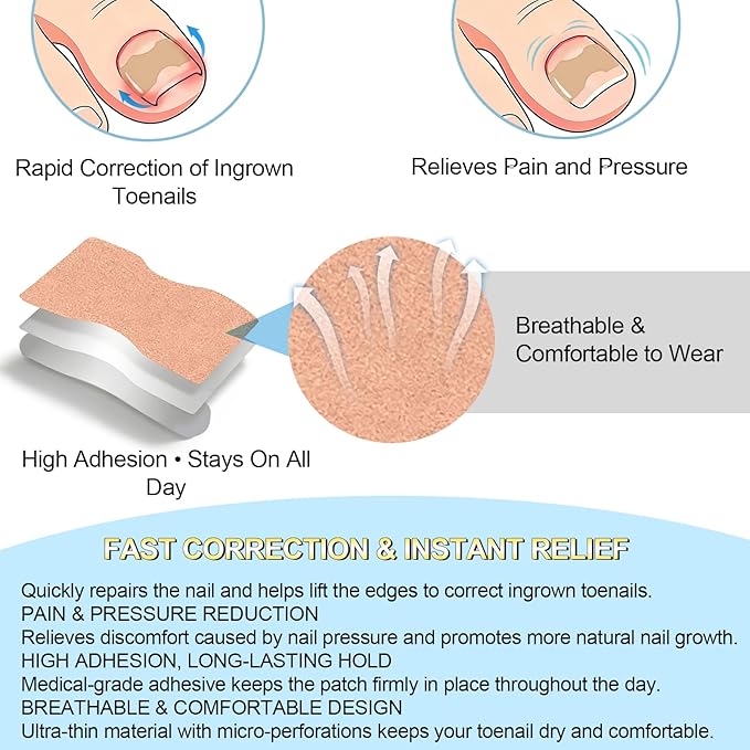 Ingrown toenail treatment，Breathable toenail correction patch, 50-piece package, can quickly repair toenails, using high-viscosity-grade glue, not easy to fall off, and easily solve toenail problems.
