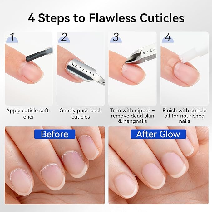Makartt Cuticle Nipper - 7mm Full Jaw Stainless Steel Cuticle Trimmer, Double Spring Precision Cuticle Cutter, Ergonomic Portable Manicure Tool for Home & Salon Nail Prep and Care (1PC Black)