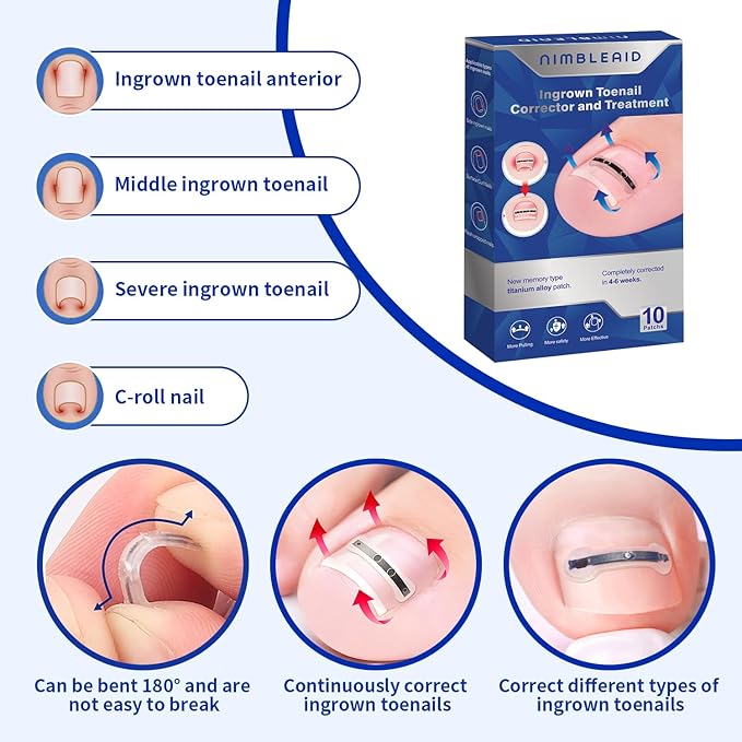 Titanium Alloy Ingrown Toenail Treatment & Corrector Kit - 3 Sizes Corrector for Men & Women Various Nail Sizes & Foot Types,Ingrown Toenail Removal Tool (10 Count-Large Size)