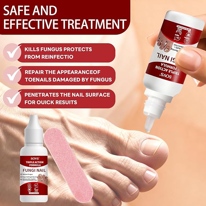 Fungi Nail Toenail Treatment,Gentle Formula, Effectively Improves Nails for a More Beautiful Appearance (2Pcs, 1 oz)
