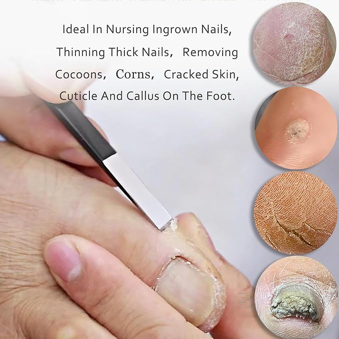 Professional Callus Knife Pedicure Knife for Feet Ingrown Toenail Knives Cuticle Foot Care Tools Dead Skin Removal Nail File Scraper
