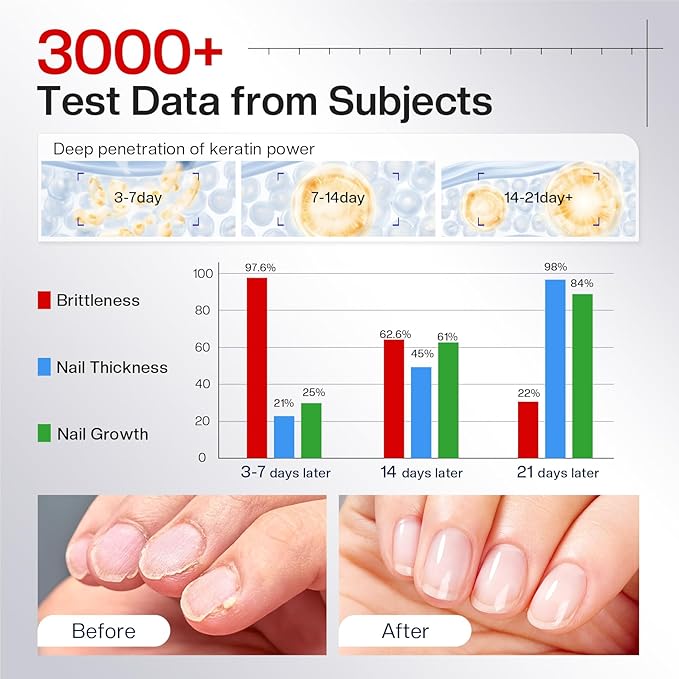 Morovan Nail Strengthener and Growth: Clear Nail Polish Hardener for Damaged Nails Treatment fragrance free Natural Keratin Repair Prevents Discoloration Crack Thin Essential Manicure Nail Care Women