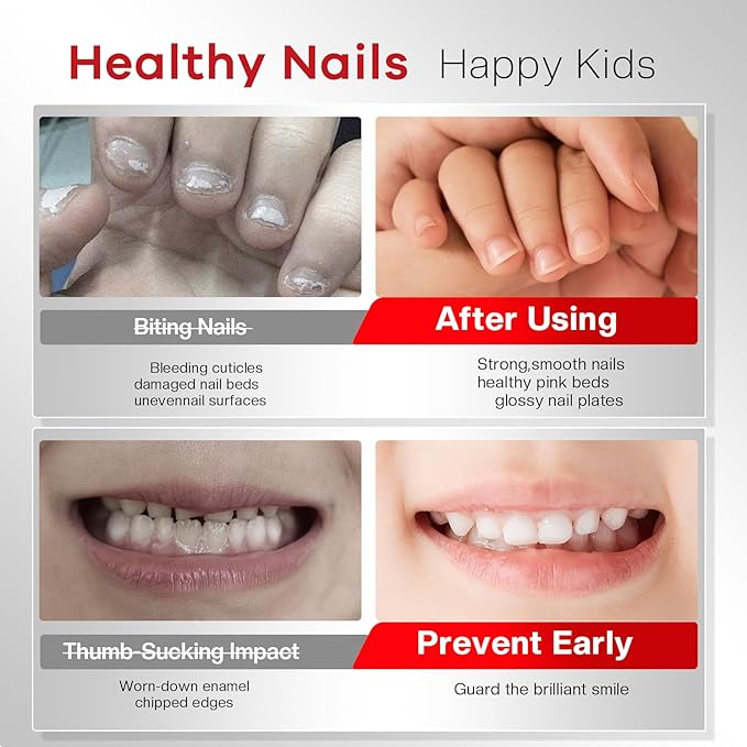2-in-1 Stop Nail Biting Treatment Kit: Extra Bitter Polish to Deter Biting & Professional Nail File to Smooth Jagged Edges Complete Solution to Remove Biting Triggers for Kids & Adults