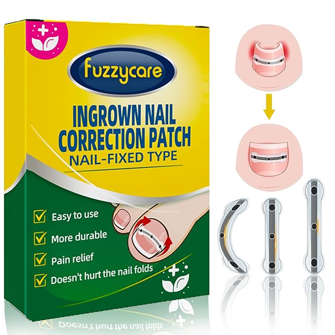 Ingrown Toenail Treatment Kit, Titanium Alloy Ingrown Toenail Removal Kit, Nails Corrector Tool & Remover Strips - Ingrown Toe Nail Quick Relief
